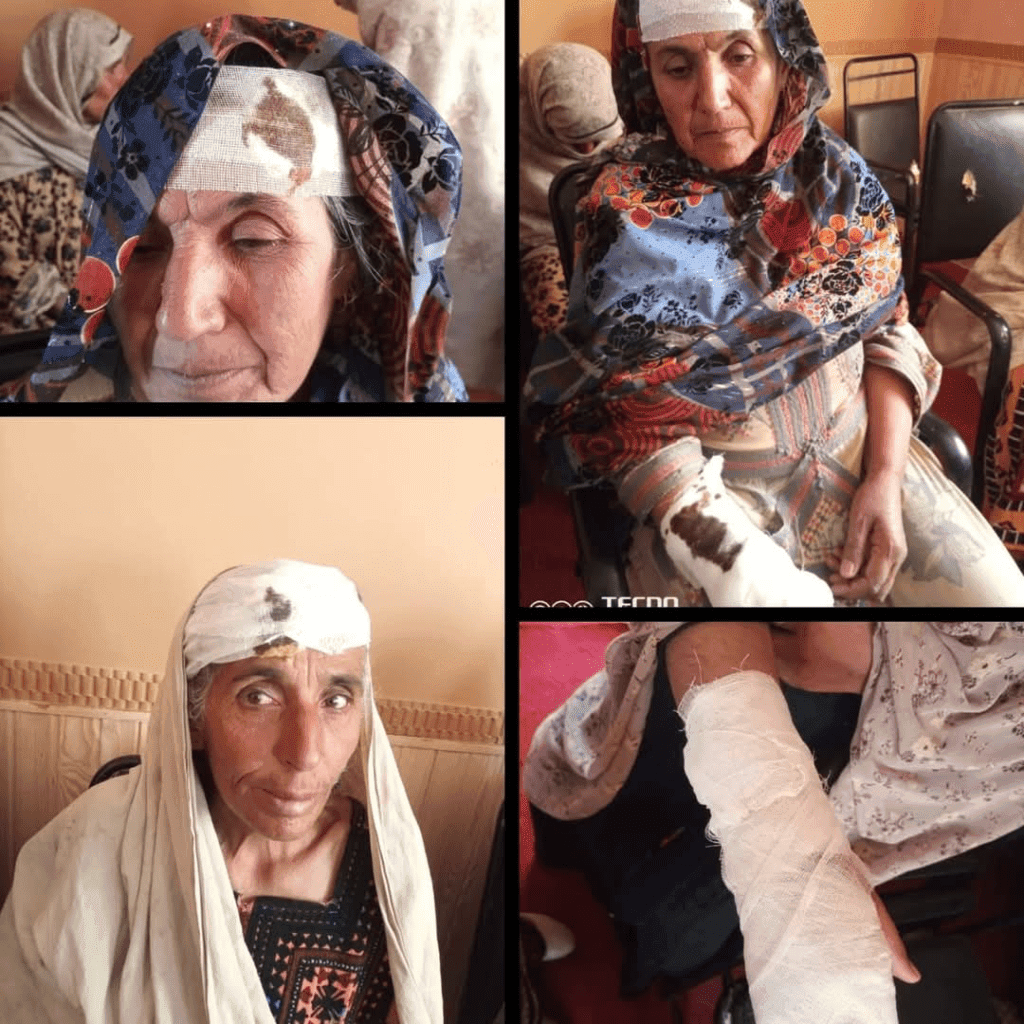 This ruthless crackdown on peaceful demonstrators exposes Pakistan’s continued disregard for human rights and the rule of law,” said Aomar Karim. 